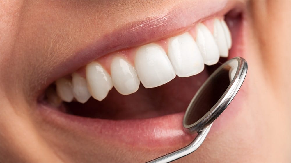 Close-up of a dental mirror examining clean white teeth in a smiling mouth