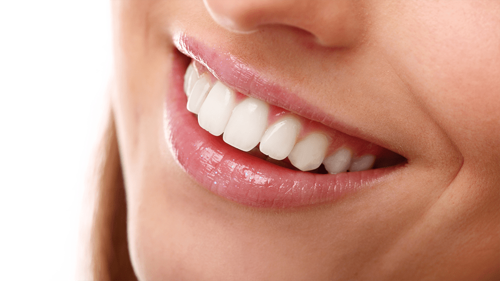 Close-up of a woman’s white smile with smooth lips and straight teeth