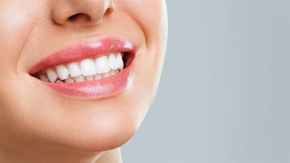 Close-up of a woman’s white smile with smooth lips and clean teeth